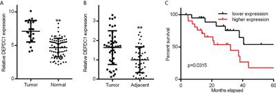 FOXM1 is regulated by DEPDC1 to facilitate development and metastasis of oral squamous cell carcinoma